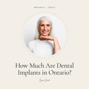 Smiling older woman resting chin on hand - dental implants cost guide for Ontario, Barton Dental