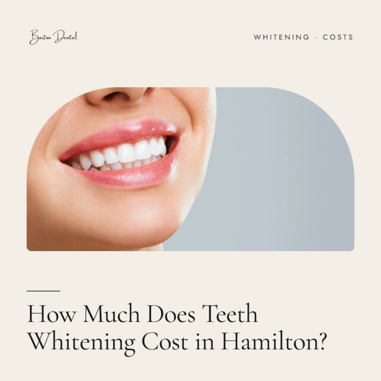 Close-up of a smiling woman's mouth with white teeth - teeth whitening cost guide, Barton Dental