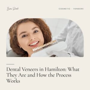 Dental Veneers in Hamilton: What They Are and How the Process Works