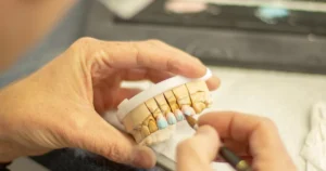 Dental technician brushing porcelain onto a row of crowns on a stone model to build a custom bridge